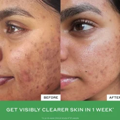 BALANCE Violet Ice Cold Plunge Pore Mask-Ole Henriksen Outlet