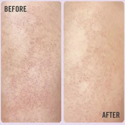 Hot DAILY ESSENTIALS KP BODY SCRUB 10% Kropspleje