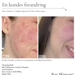 Clearance Repair Salve 15 ml Kropspleje