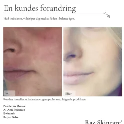 Clearance Repair Salve 15 ml Kropspleje