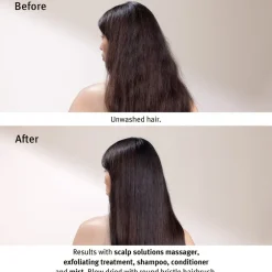 Sale Scalp Solutions Stimulating Scalp Massager Hudpleje-Tilbehør