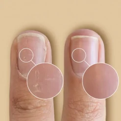 SolarOil Nail & Cuticle Treatment PEN-CND Best