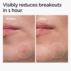 Sulfur 10% Powder-to-Cream Concentrate-The Ordinary Best