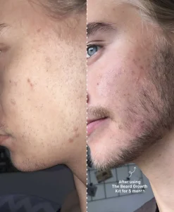 The Beard Growth Kit-Copenhagen Grooming Clearance