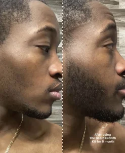 The Beard Growth Kit-Copenhagen Grooming Clearance