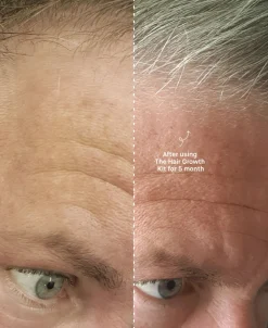 The Hair Growth Kit-Copenhagen Grooming Best