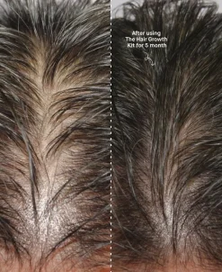 The Hair Growth Kit-Copenhagen Grooming Best